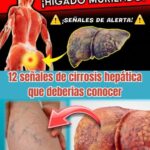 ¿Tu Hígado Está en Peligro? 12 Señales de Cirrosis Hepática que No Debes Ignorar