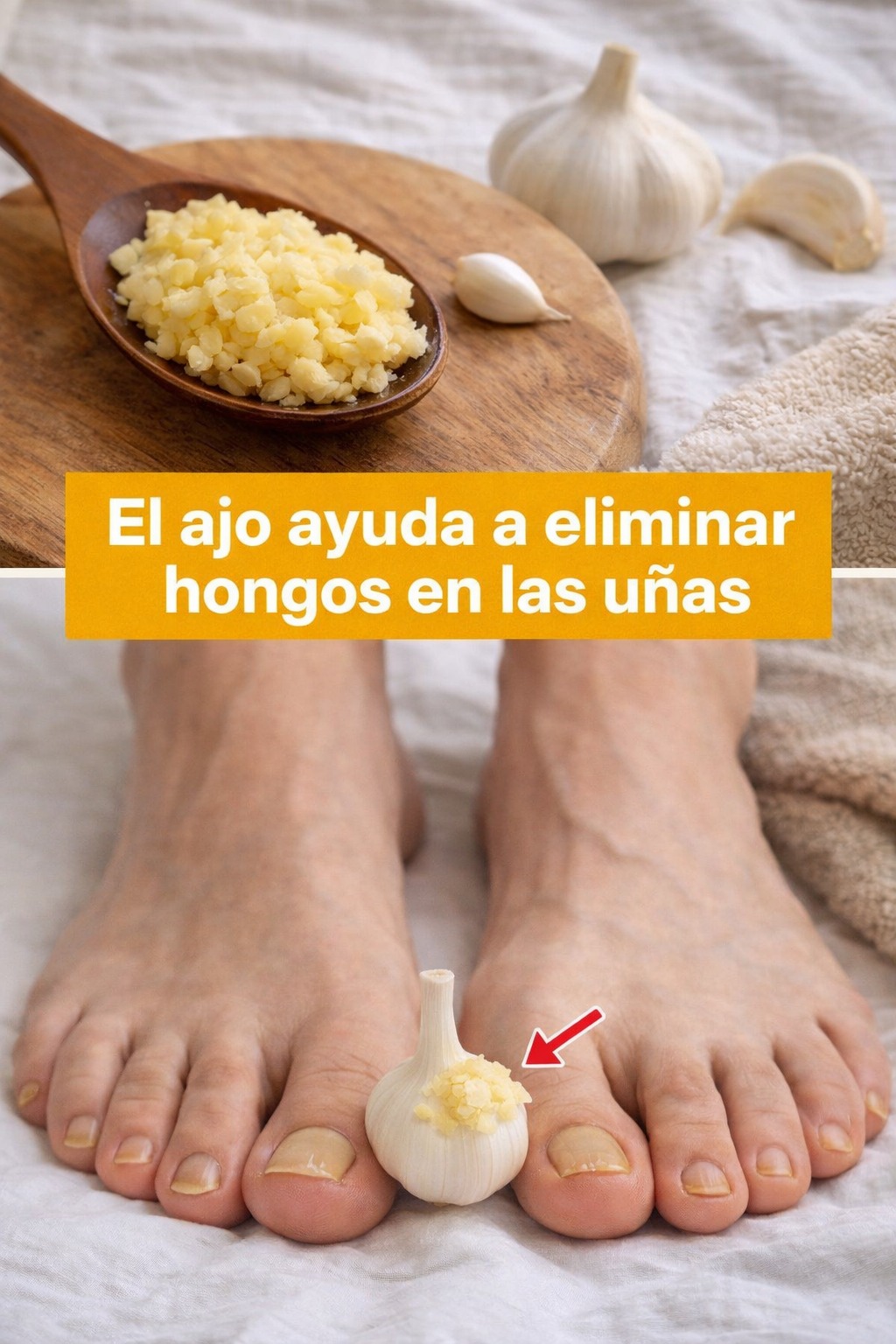 Ajo como remedio natural para las uñas
