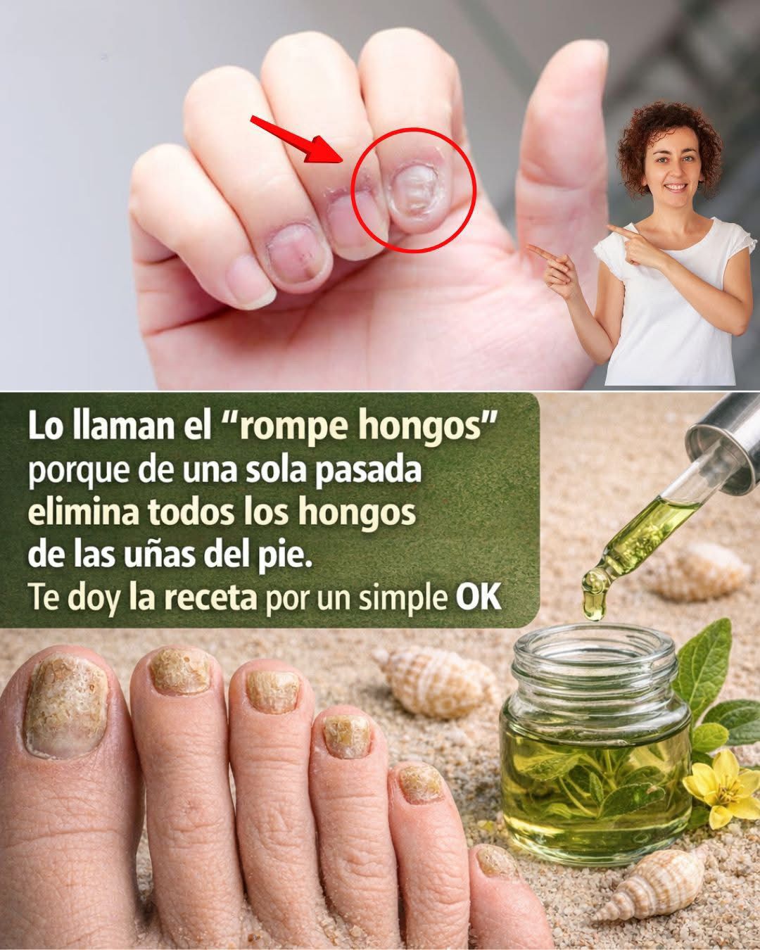 Rompe hongos solución natural