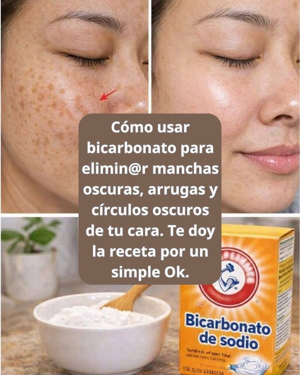 Remedio casero con bicarbonato