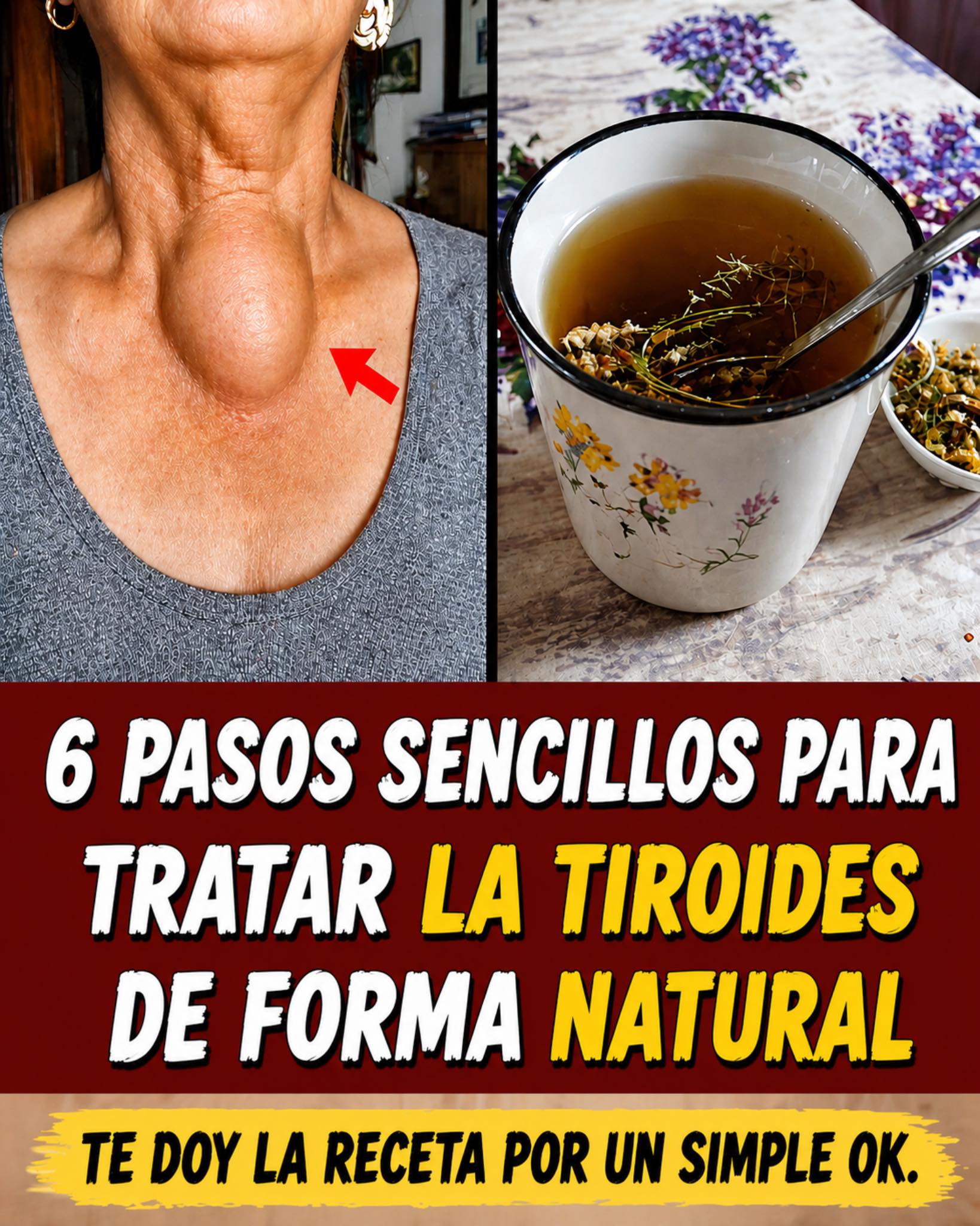 Salud y tiroides
