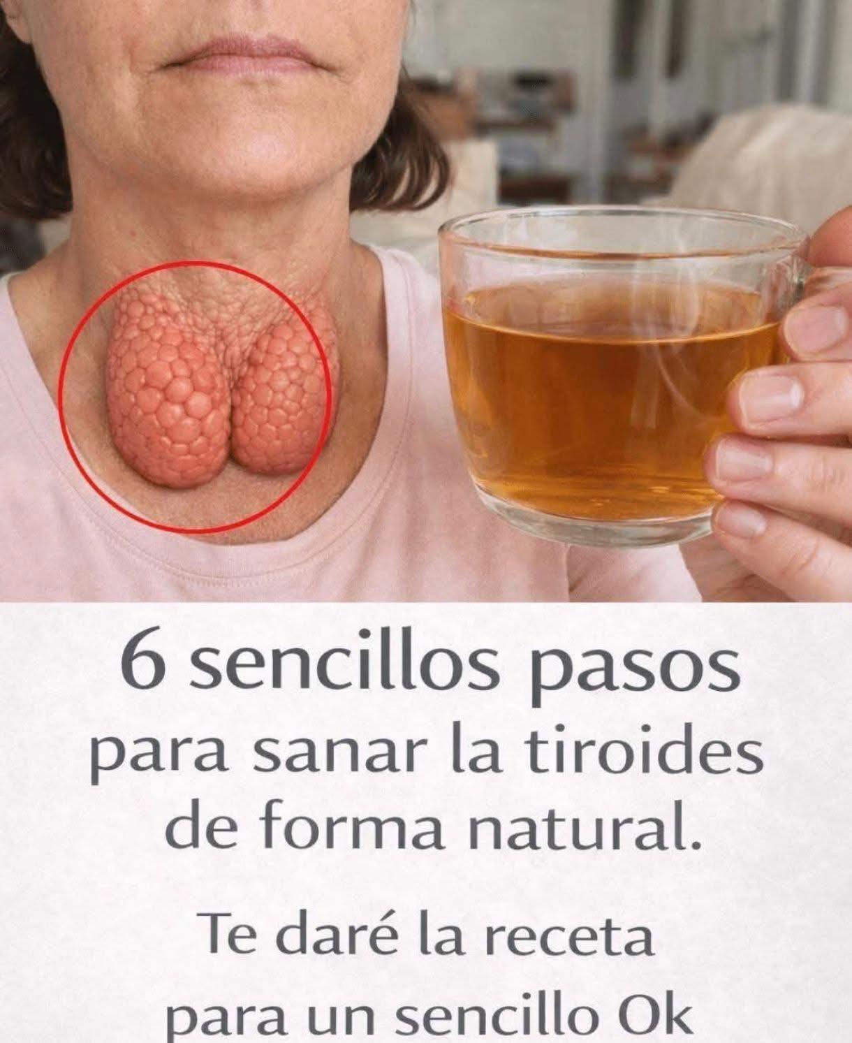 Salud de la tiroides