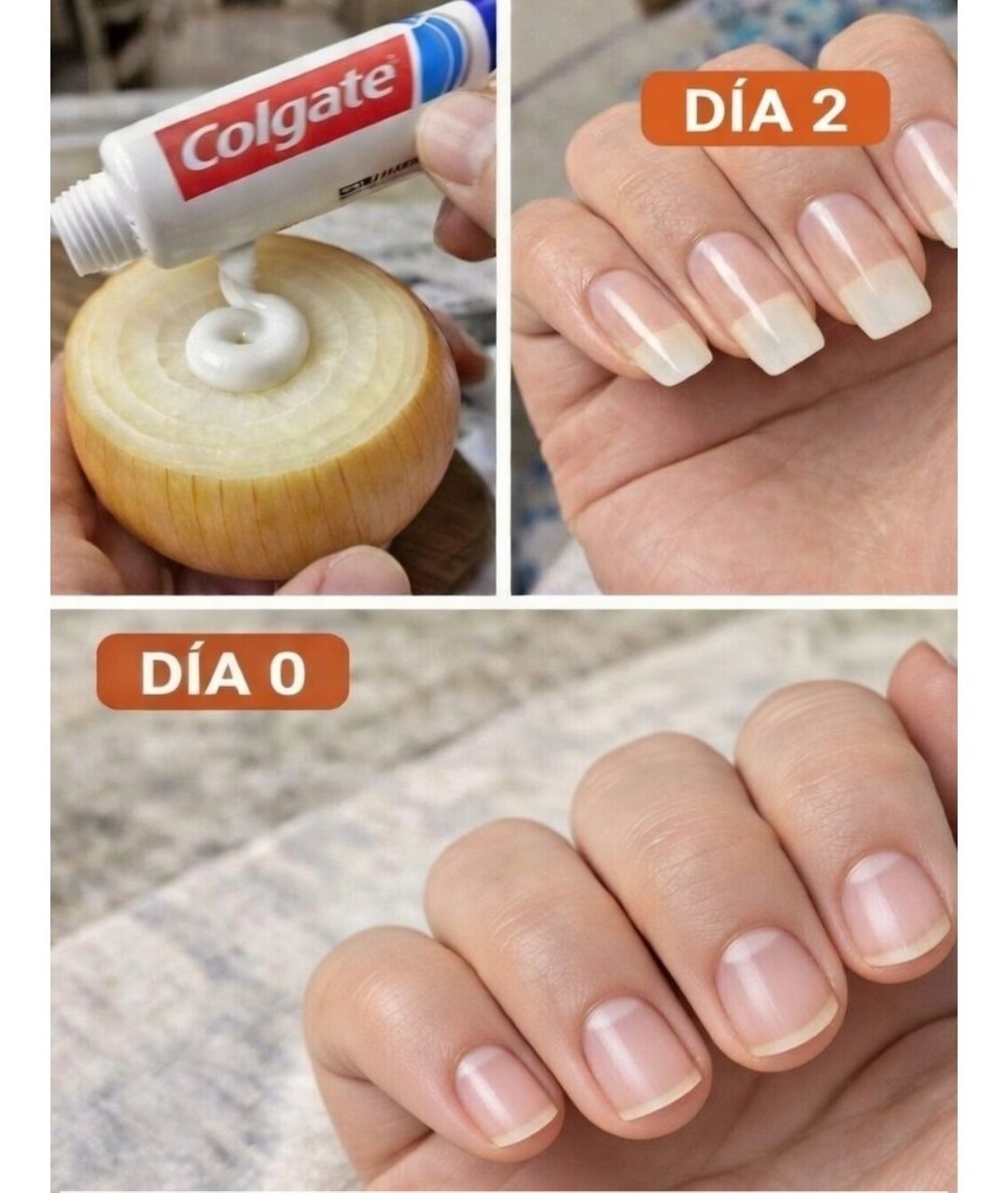 Receta para hacer crecer las uñas