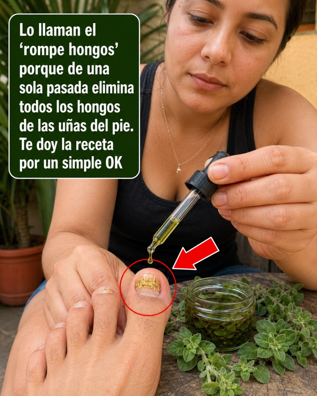 Aplicación de tratamiento de orégano para hongos en las uñas