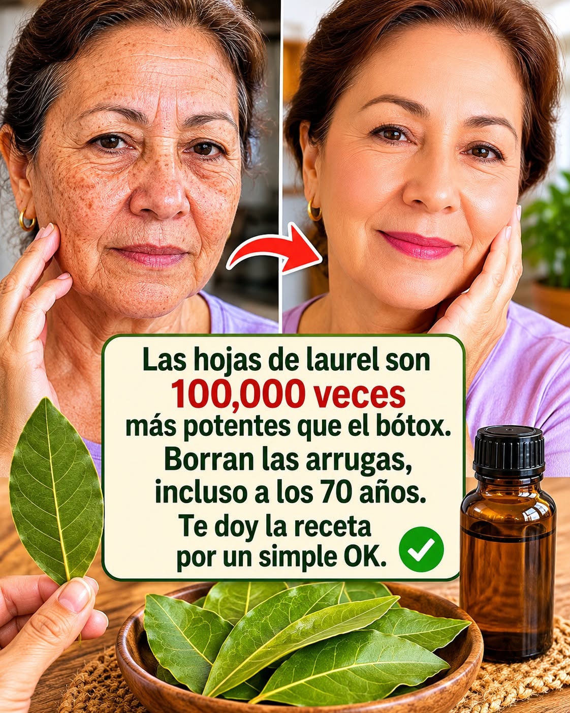 Beneficios del laurel para la piel