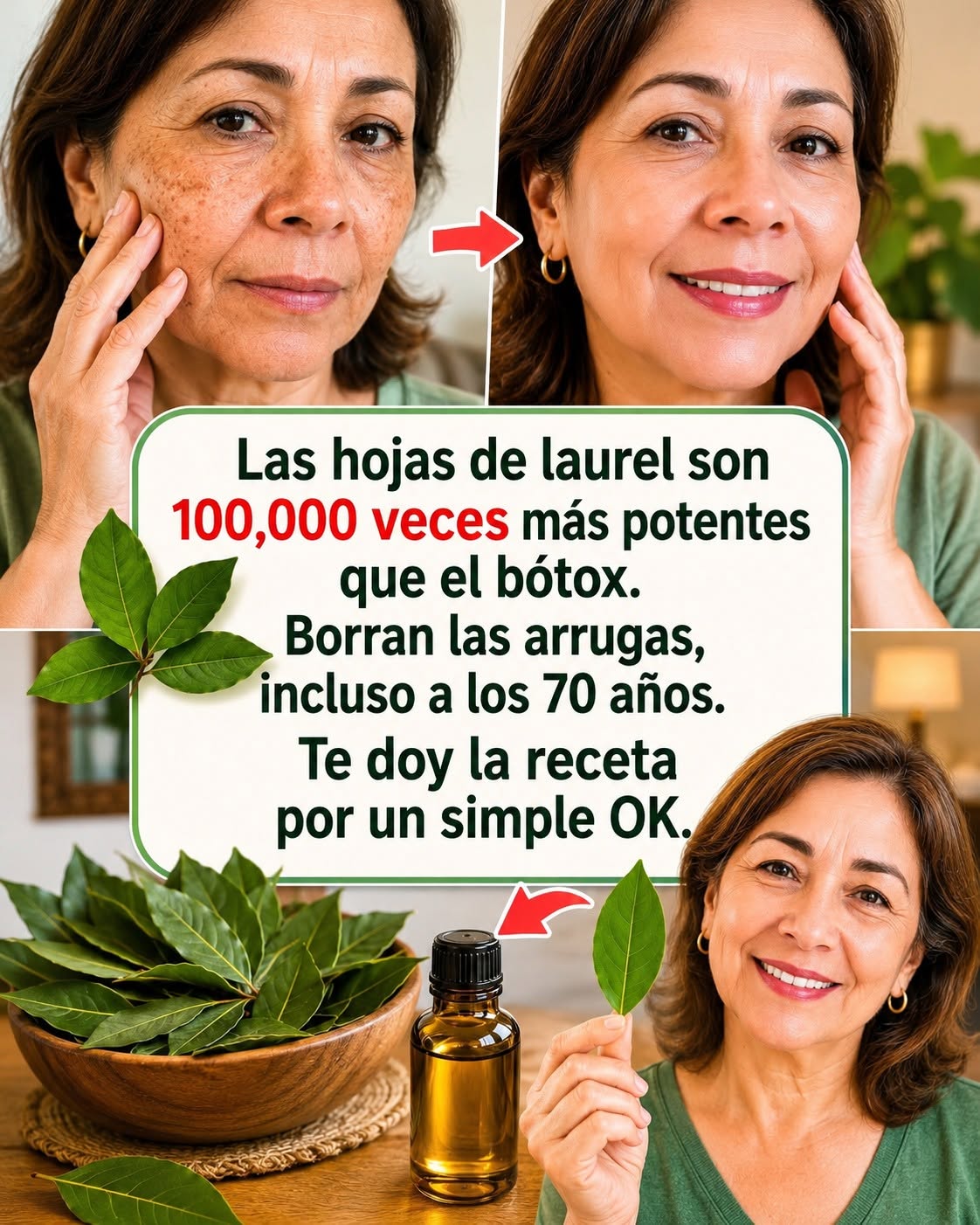 Recetas con Hojas de Laurel para el Cuidado de la Piel
