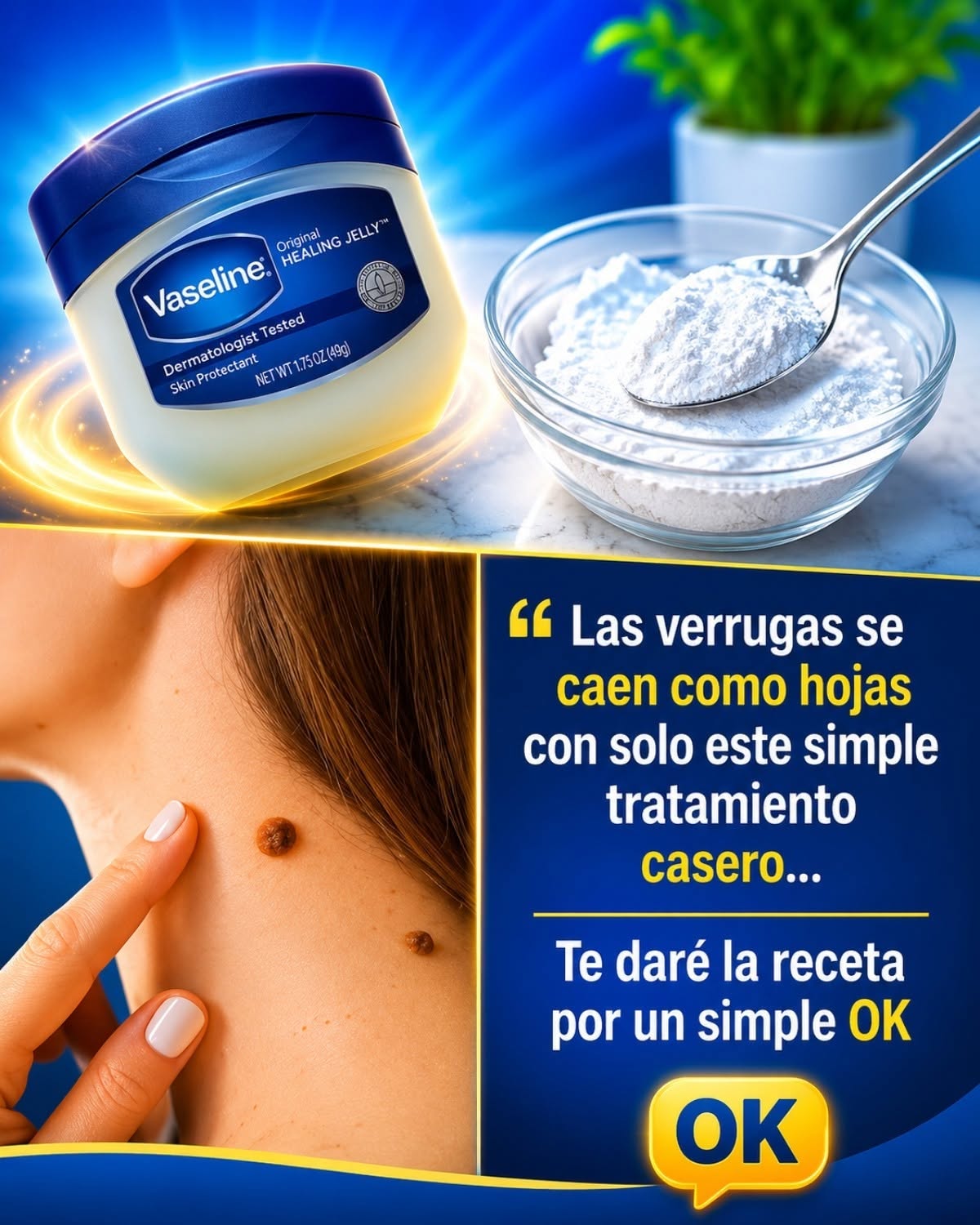 Tratamiento casero para verrugas
