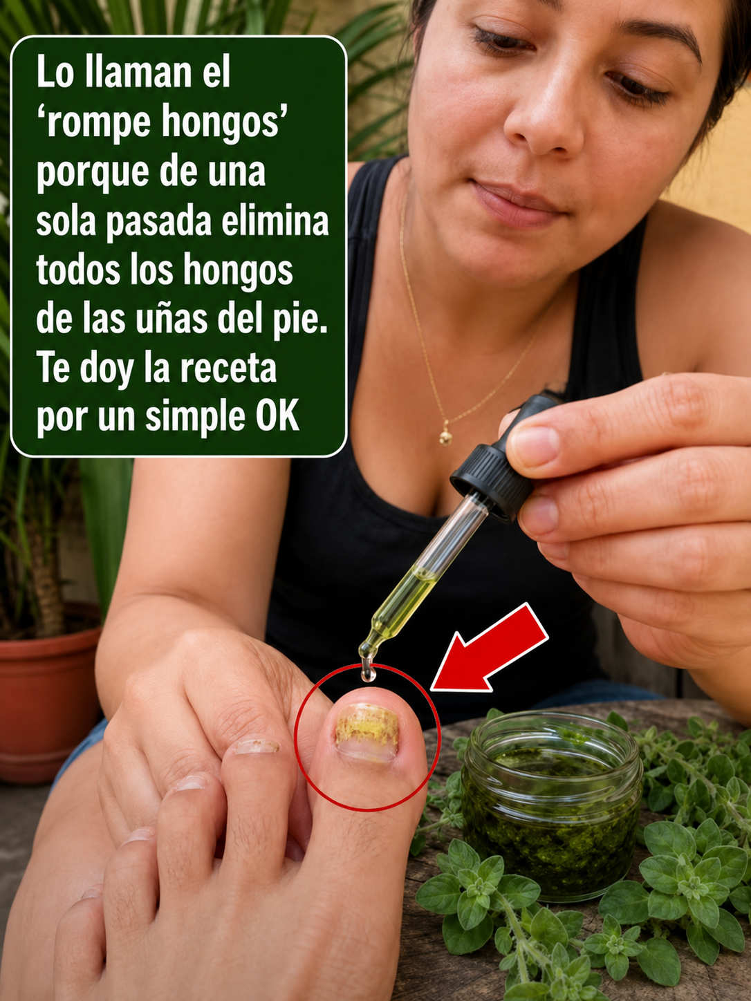 Remedios caseros hongos en las uñas