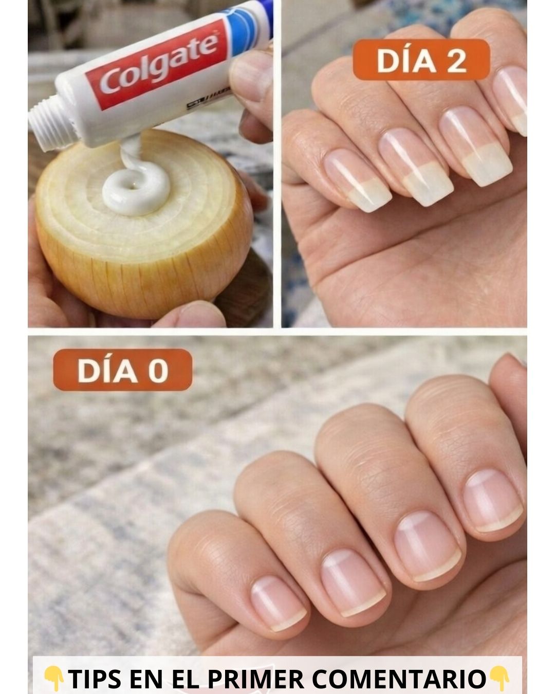 Cómo hacer crecer las uñas