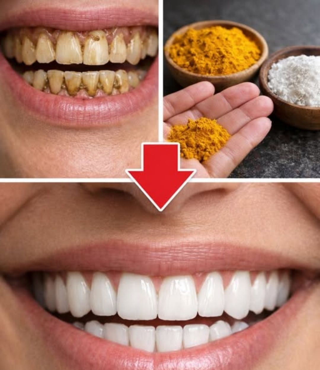 Proceso de Blanqueamiento Dental Natural