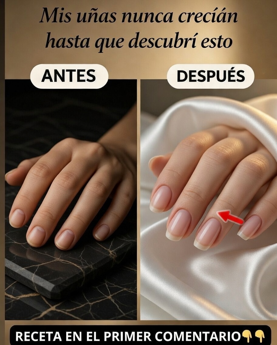 Antes y después del crecimiento de uñas