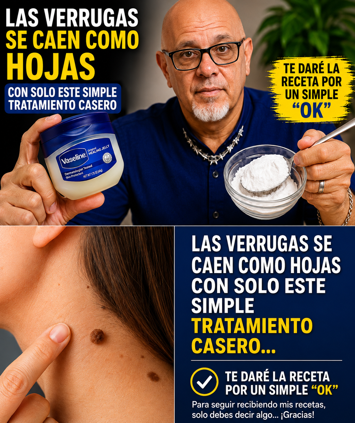 Las verrugas y su tratamiento natural