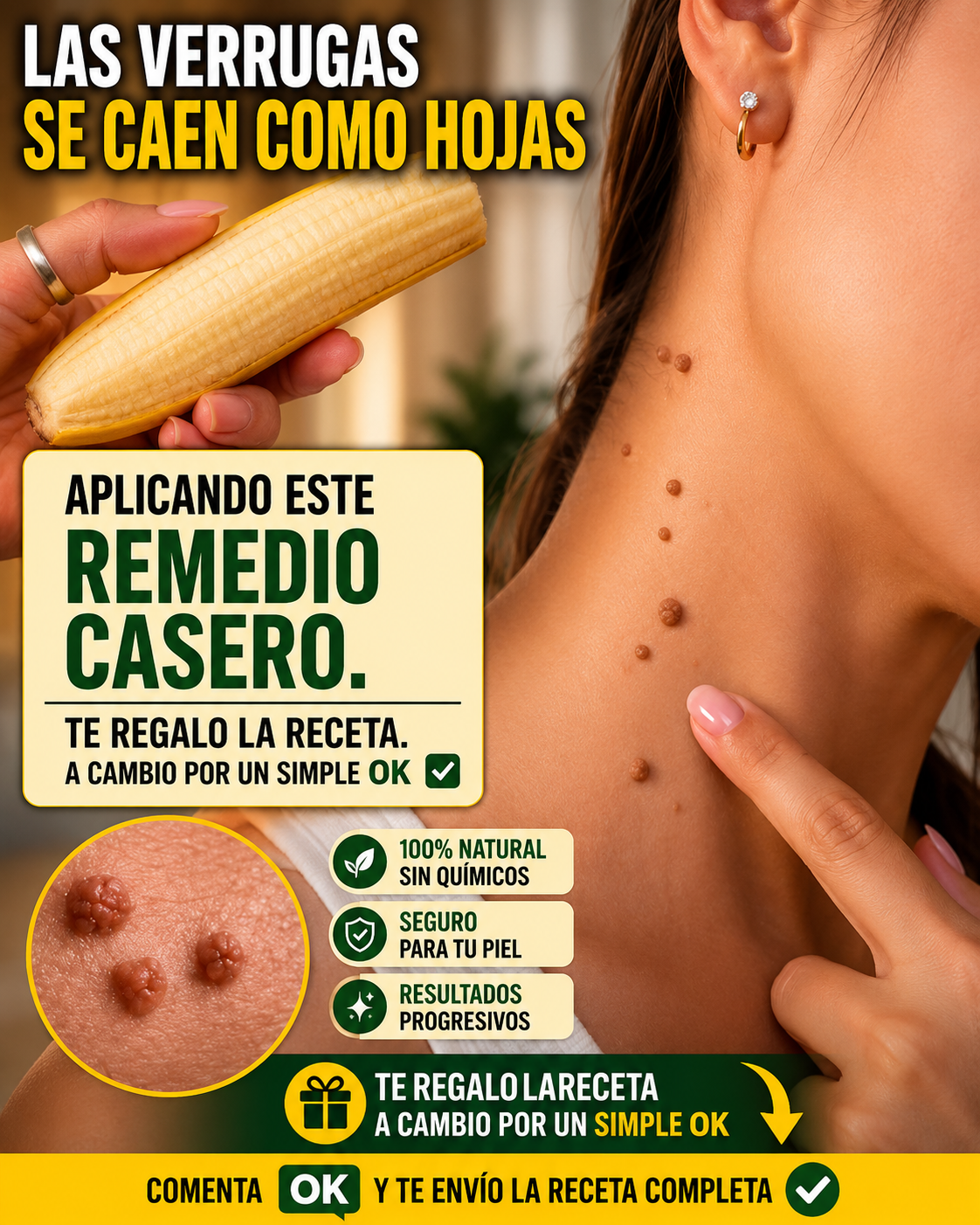 Cáscara de Plátano