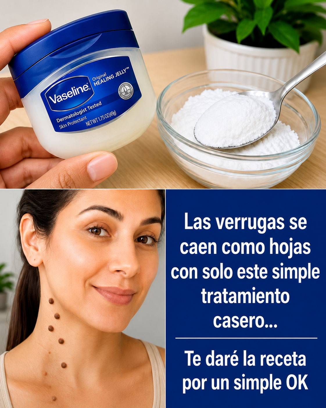 Verrugas en la piel